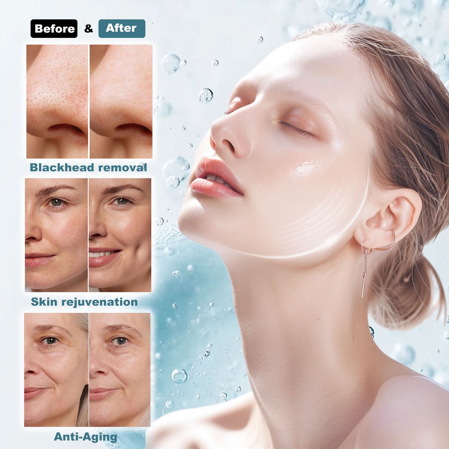 7-in 1 skin care facial machine before and after